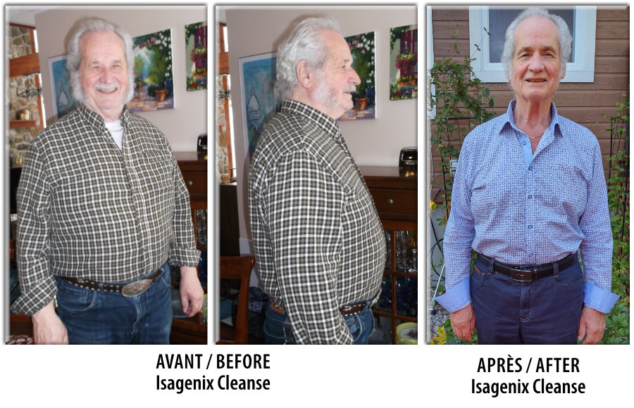 Norman Before After